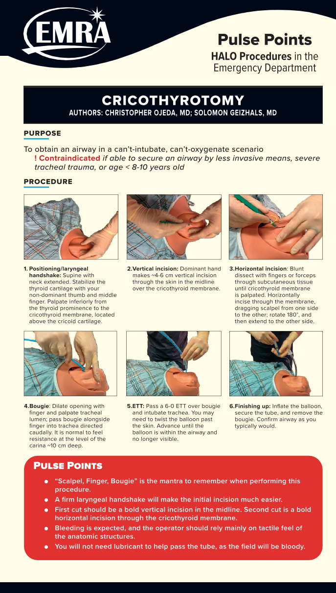 Pulse Points: High-Acuity, Low-Occurrence Procedures Card