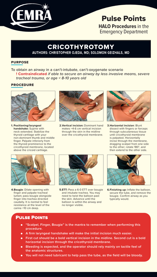 Pulse Points: High-Acuity, Low-Occurrence Procedures Card