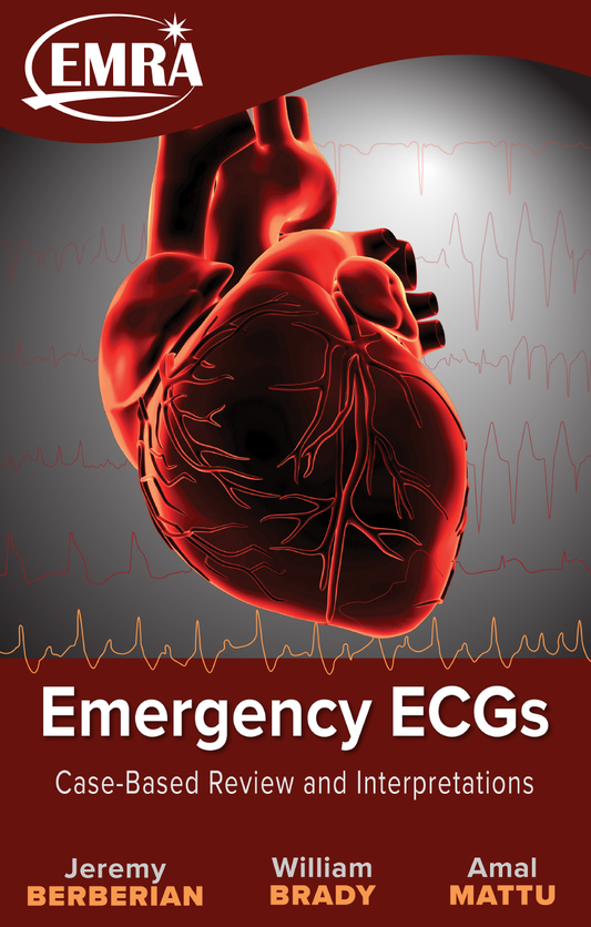 Emergency ECGs (Kindle)