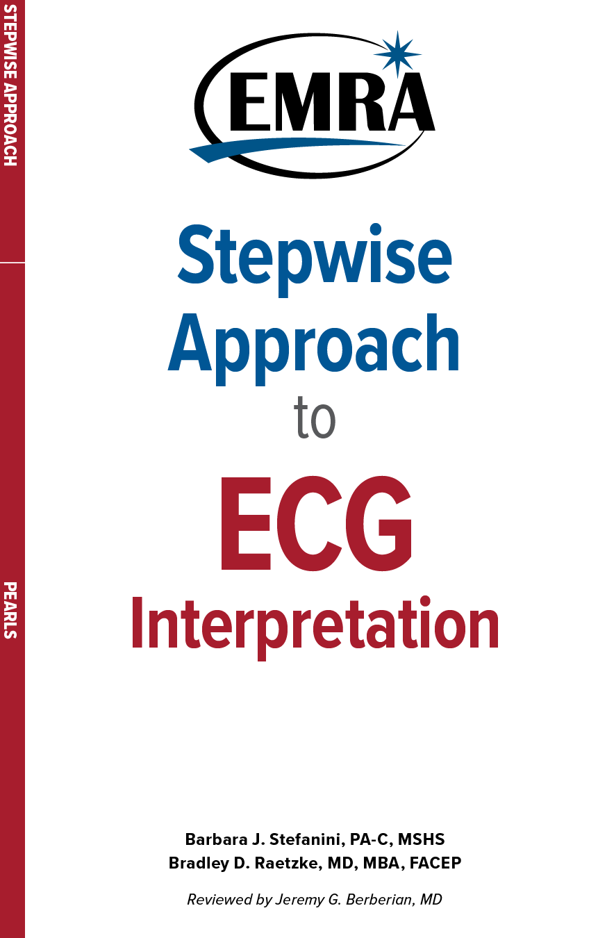 Stepwise Approach to ECG Interpretation Card